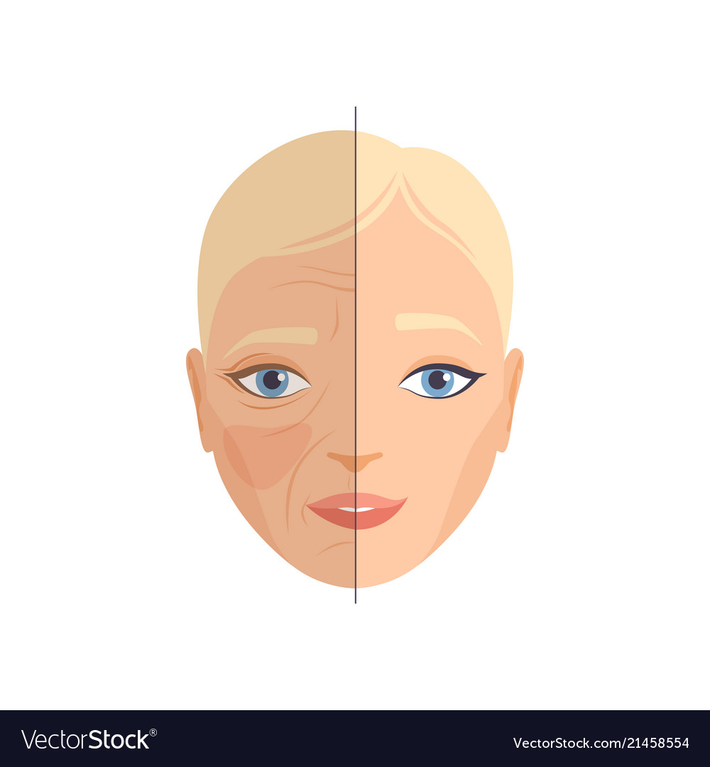 Face of woman before and after cosmetic procedure Vector Image