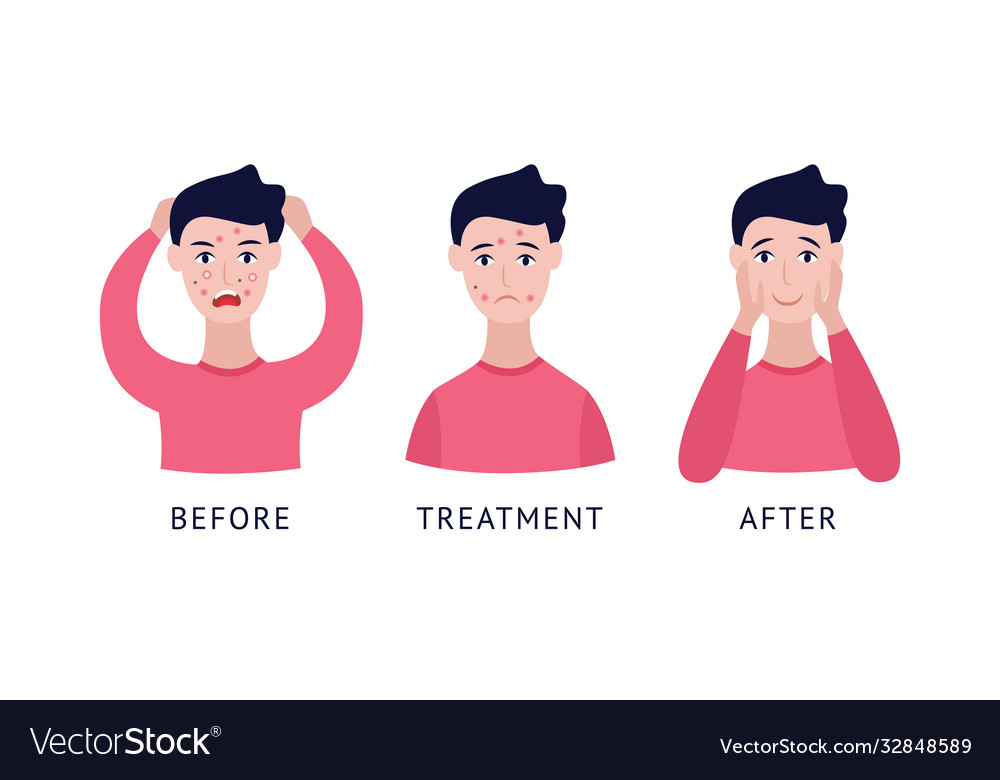 Set Mann mit Akne vor und nach der Behandlung