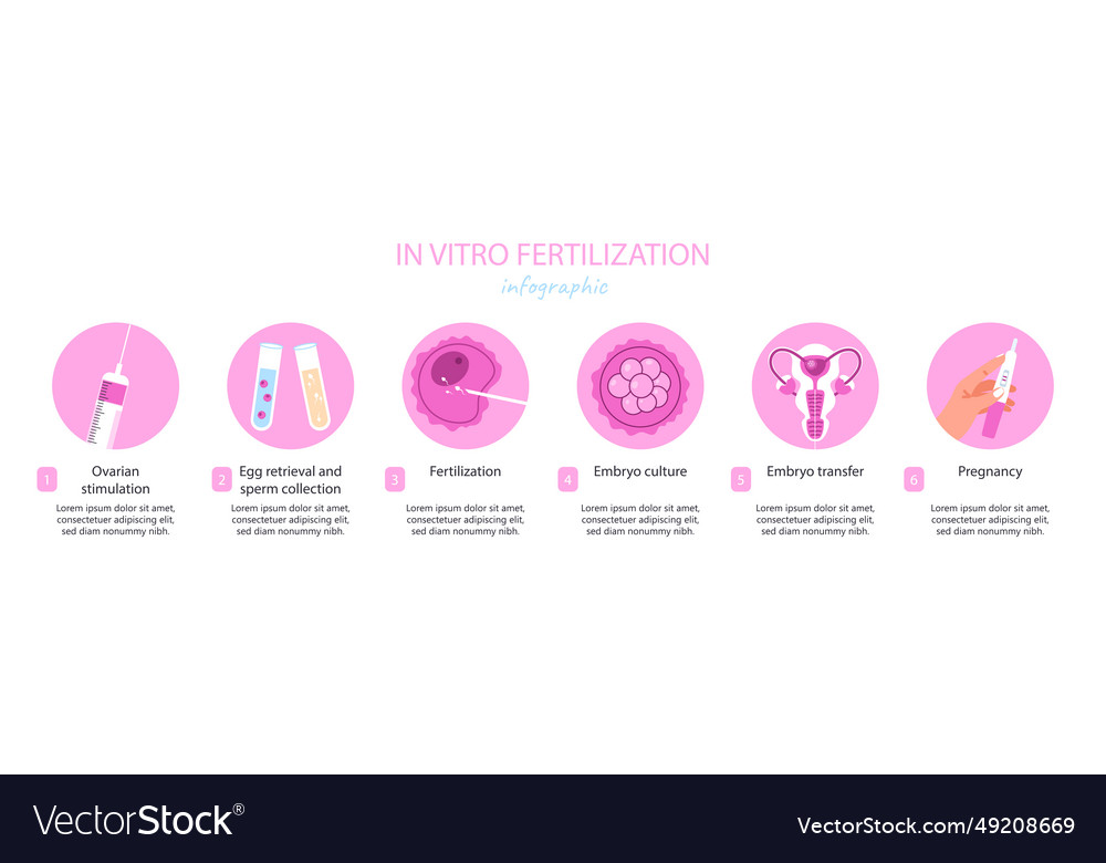 Ivf infographic concept Royalty Free Vector Image