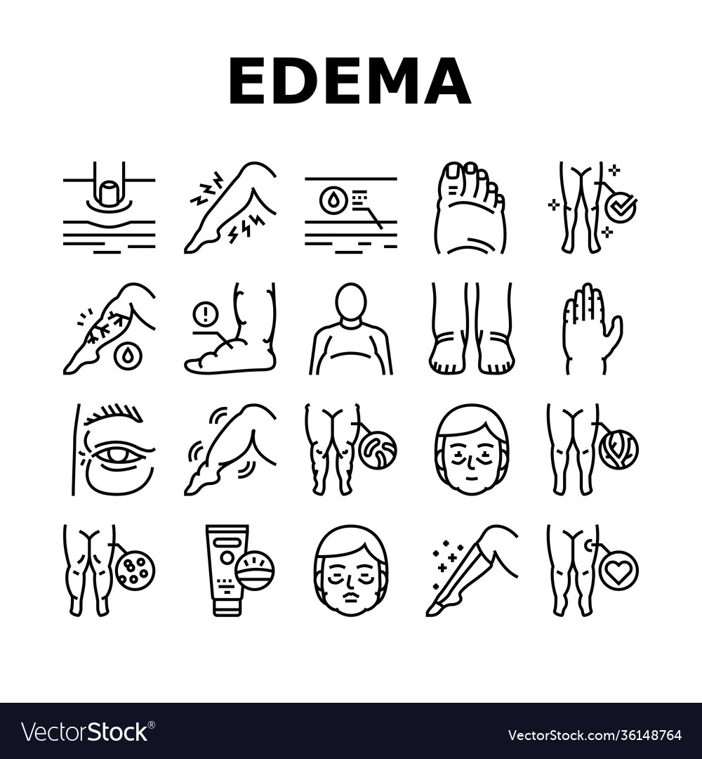 Edema disease symptom collection icons set Vector Image