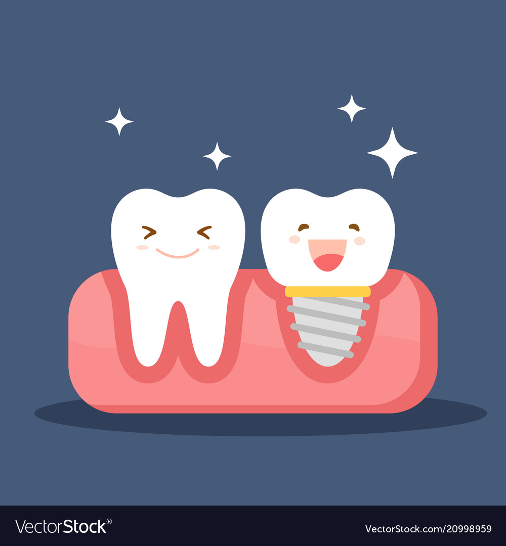 dental implant and a normal tooth restoration in vector image