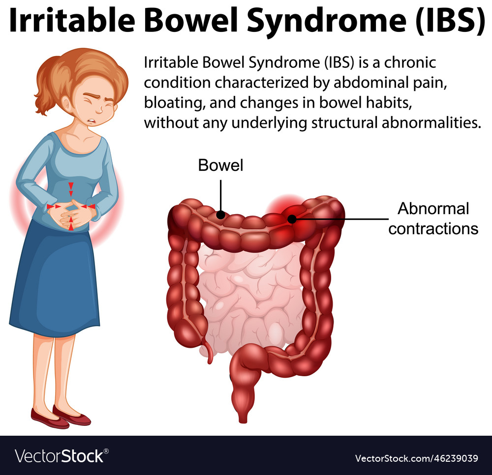 Irritable bowel syndrome ibs infographic Vector Image