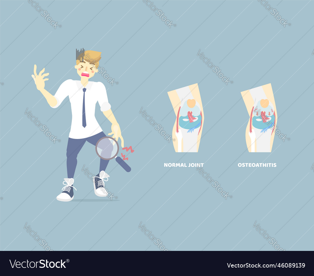 Man having knee arthritis anatomy and bone vector image Man having knee arthritis anatomy and bone