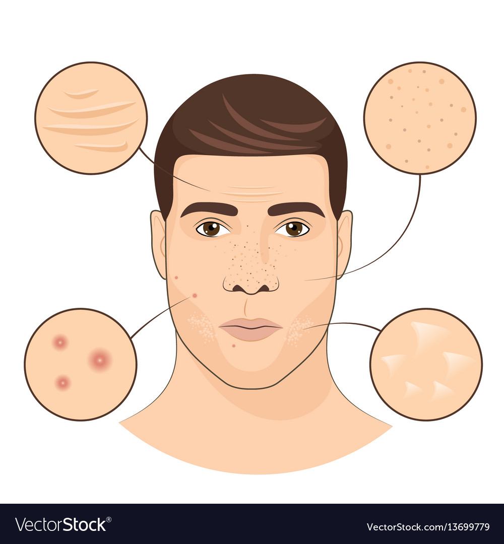 Man portrait with facial treatments face skin Vector Image