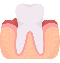 Gingivitis Tooth Problem