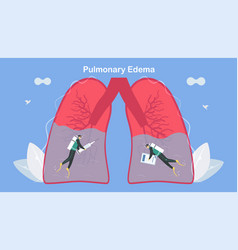 Pulmonary Edema Is Symptom That Lungs Fill