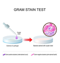 Gram Stain Test A Glass Petri Dish With Pathogen