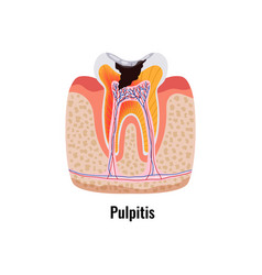 Dental Disease Poster