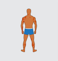 Male Silhouette From Behind In Swimming Trunks