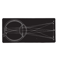 A Diagram Of The Retina And Crystalline Lens