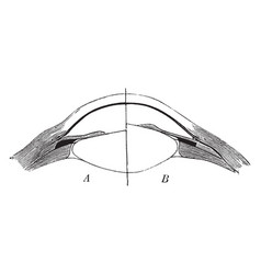 Use Of The Crystalline Lens Vintage