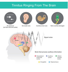 Tinnitus Ringing