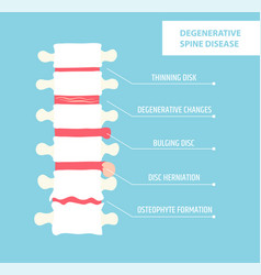 Degenerative Disc Disease Spinal Arthritis