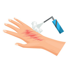 Hands Injured Skin And Procedures Of Wound