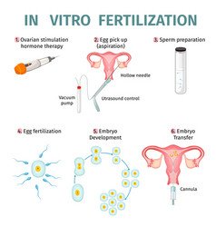 In Vitro Fertilization Concept