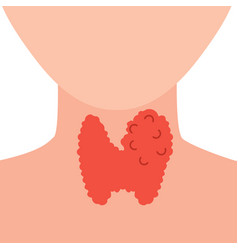 Enlarged Thyroid Gland On Neck Silhouette Diagram