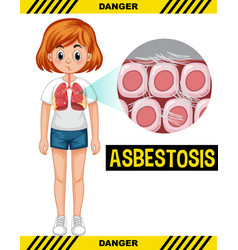 Diagram Showing Aspergillus Infection