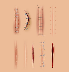 Realistic Scars Medical Surgical Sutures Wounds