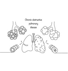 Pulmonary Obstruction