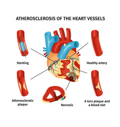 Heart Anatomy Infograpics