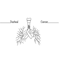 Tracheal Cancer