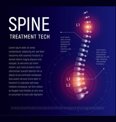 Spine Injury Treatment Xray Human Back