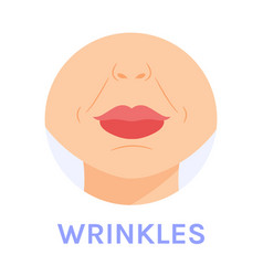 Nasolabial Facial Marionette Wrinkles Near Lips