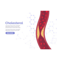 Cholesterol Artery Thrombosis Micro Vascular