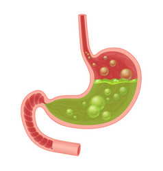 Realistic Medical Of Nausea Stomach