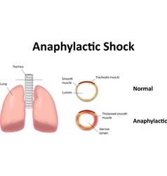 Anaphylactic Shock Lungs