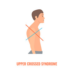 Crooked Man With Upper Crossed Syndrome Imbalance