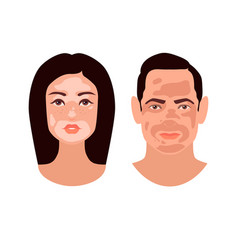 European Woman And Man Faces With Vitiligo