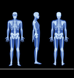 Set Of X-ray Skeleton Human Body - Hands Legs