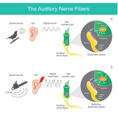 Auditory Nerve Fibres Comparison Sound Source 2