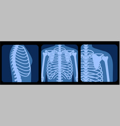 Skeleton X Ray