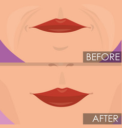 Woman Lips Before And After Treatment