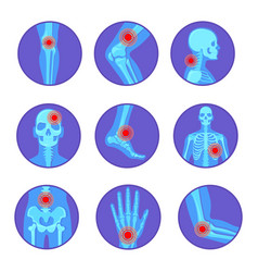 Orthopedic Joint Diseases Rheumatoid Pain Bone