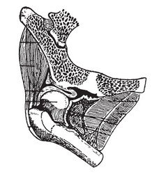 Congenital Dislocation Of The Hip Vintage