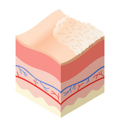 Skincare Medical Concept Problems In Cross