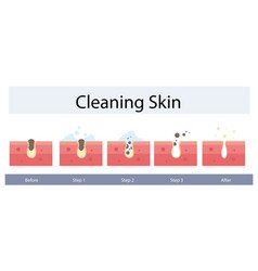 Facial Skin Care Pore Cleaning Concept Cleansing