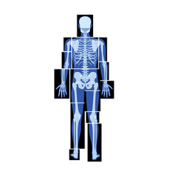 Set Of X-ray Skeleton Human Body Parts - Hands