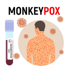 Monkeypox Pandemic Poster Smallpox Man Test Tube