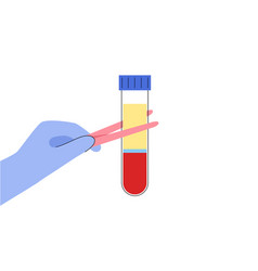 Platelet Rich Plasma Concept