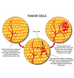 Tumor Cells