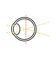 Medical Of Vision And Refractive Errors By Myopia