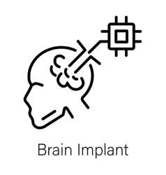 Brain Implant