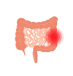 Cartoon Intestinal Tract Like Irritable Bowel