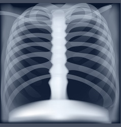 Xray Medical Image Chest