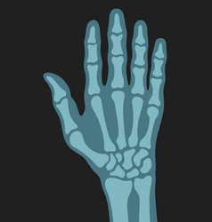 X Ray Right Human Hand Ultra Skeleton Body Bone