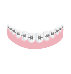 Metal Dental Braces On Straight Teeth In Jaw Gum